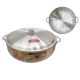 Bistro Large Stock Pot with Lid Aluminum 42 x 14 cm (16.5 x 5.5 in.) (713-D42)